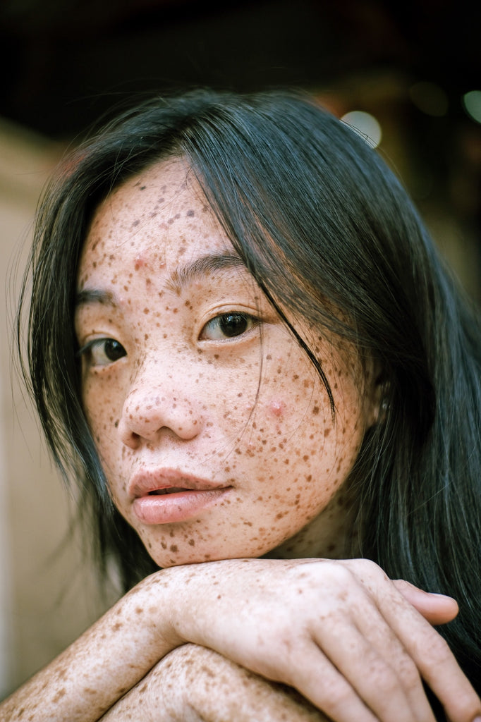 young asian girl with freckles looking at camera